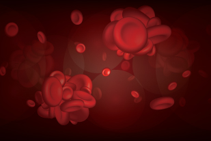 Coagulation Profile